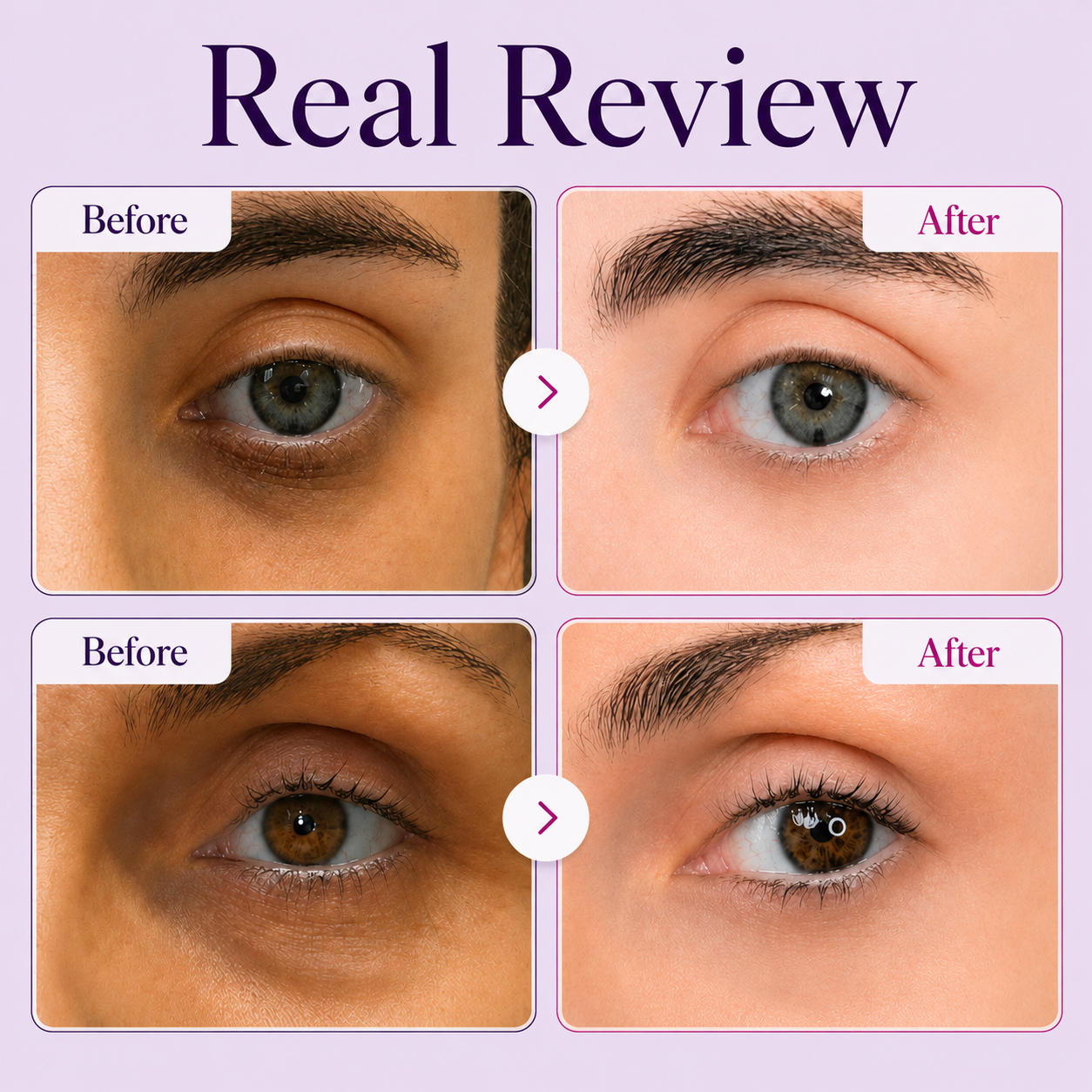 Peauvelle™ Calcium Dark Spot Eye Cream