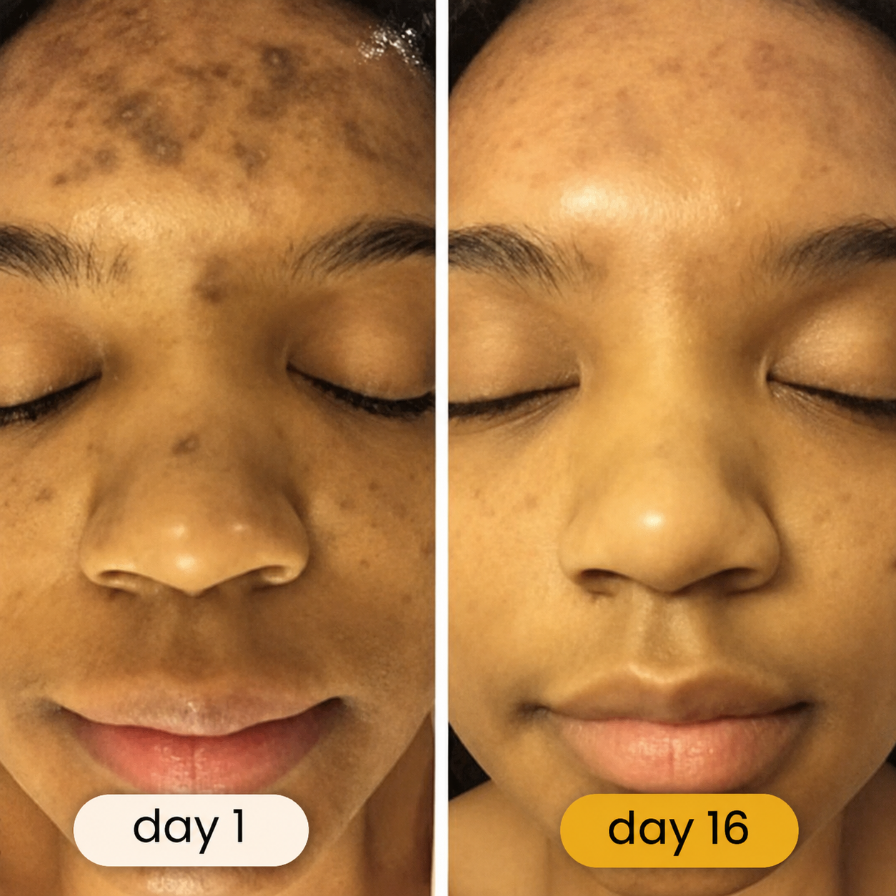 Turmeric & Kojic Acid Cleansing Pads (20 Pads)
