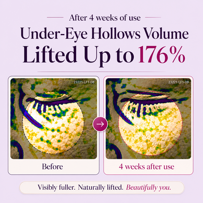 Peauvelle™ Calcium Dark Spot Eye Cream