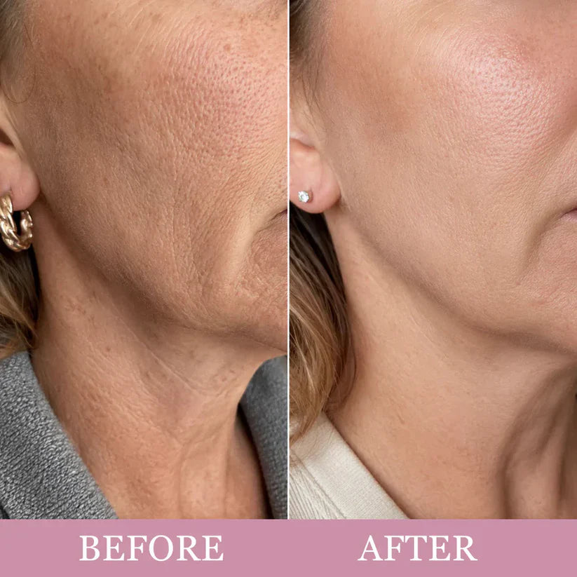 Mirevyn COLLAGEN GUA SHA NECK WRINKLE CREAM