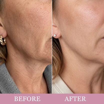 Mirevyn COLLAGEN GUA SHA NECK WRINKLE CREAM